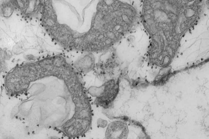 Dying mitochondria microscopy image